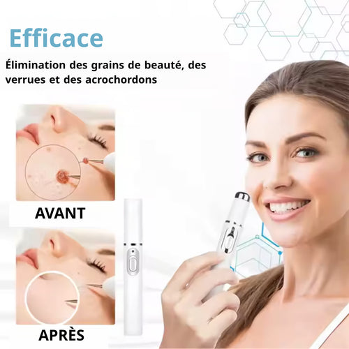 Stylo Laser ProMax – Grains & Verrues KO!