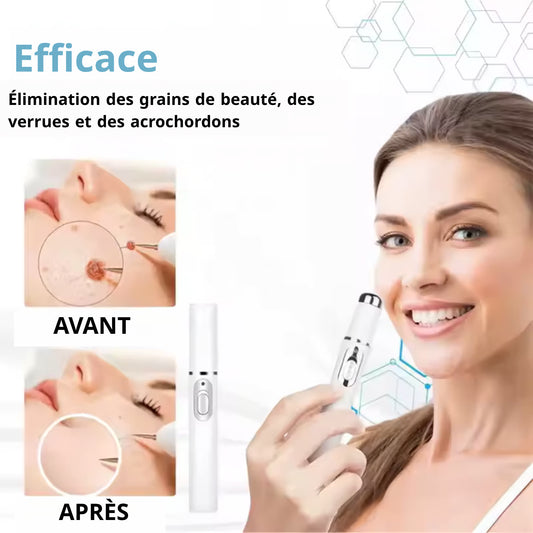 Stylo Laser ProMax – Grains & Verrues KO!