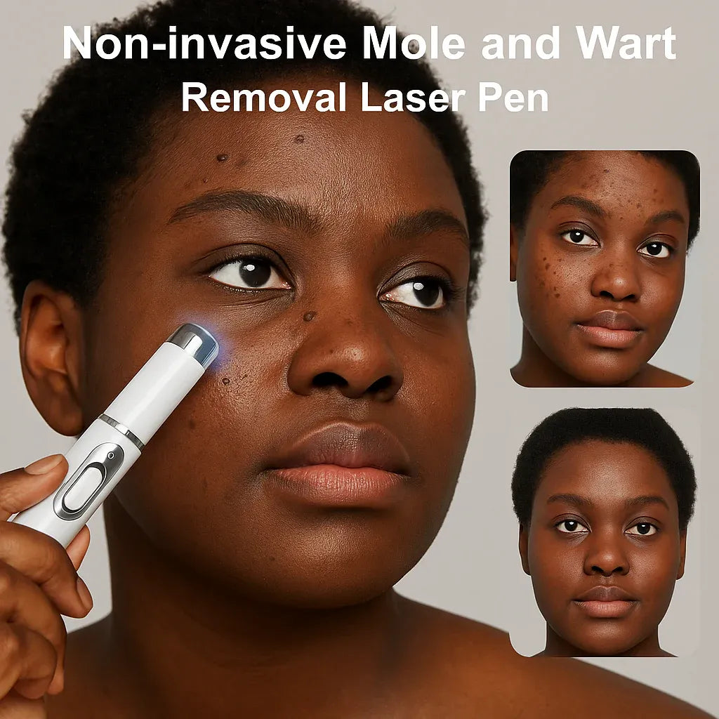 Stylo Laser ProMax – Grains & Verrues KO!