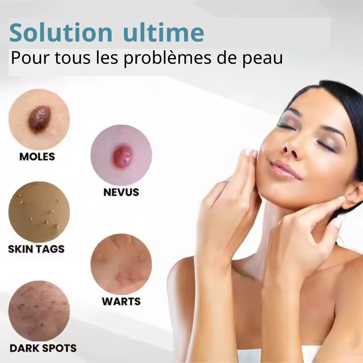 Stylo Laser ProMax – Grains & Verrues KO!