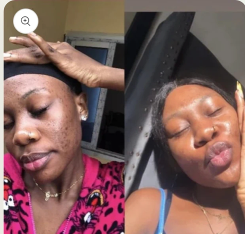 Savon Kojic Éclat Naturel – Ta Peau d’une Douceur Lumineuse, Éclatante et Lisse