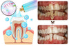 Dentifrice au Niacinamide - Souriez en toute confiance BODYARCEL (CFQ)