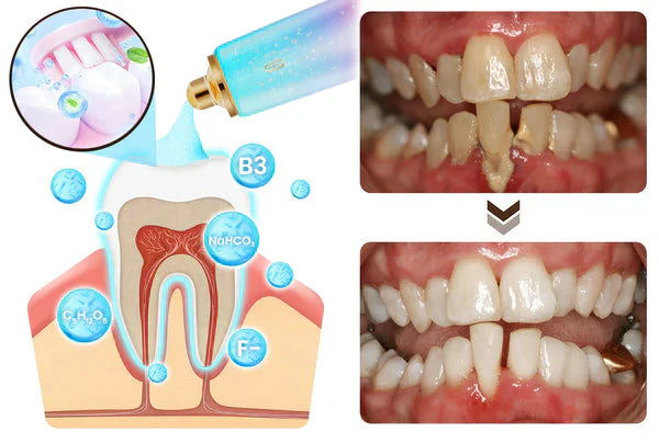 Dentifrice au Niacinamide - Souriez en toute confiance BODYARCEL (CFQ)