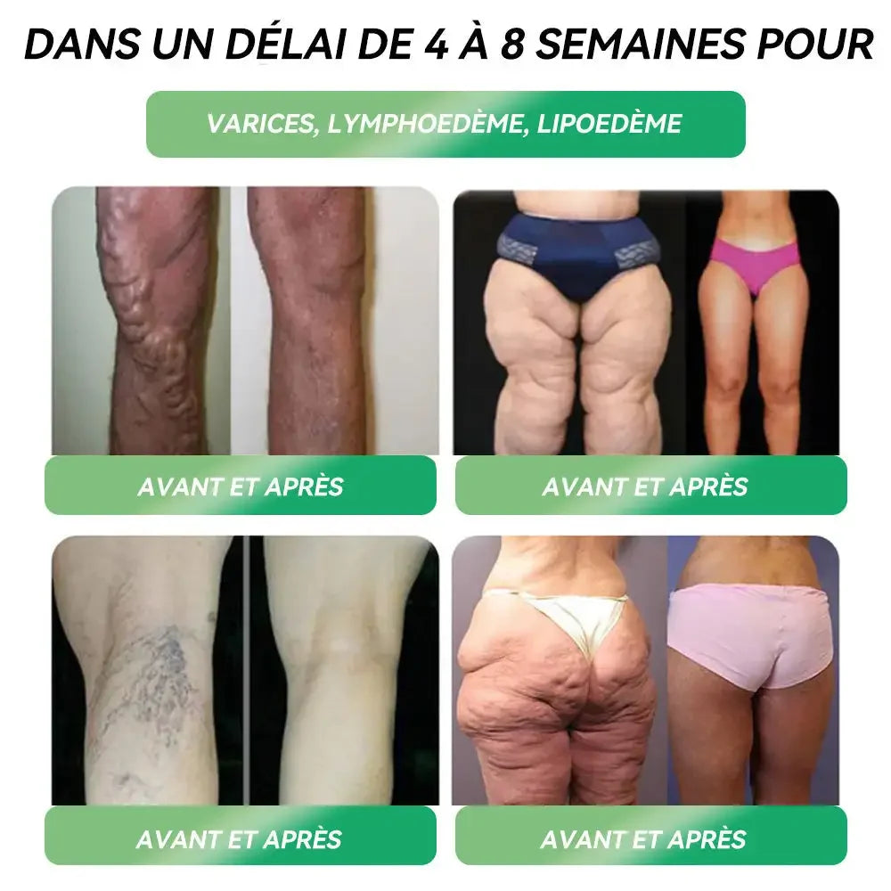 GLP-1 Six en Un : le secret pour mincir naturellement