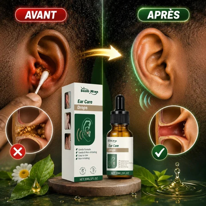 Gouttes auriculaires douces pour soulager les acouphènes