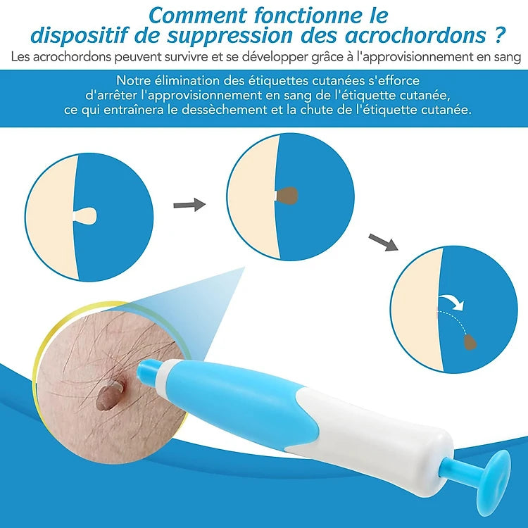 Kit DermaSkin Pro™ – Adieu Les Acrochordons, Résultat Immédiat