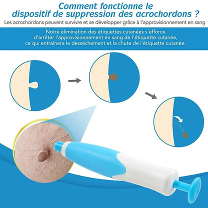 Kit DermaSkin Pro™ – Adieu Les Acrochordons, Résultat Immédiat