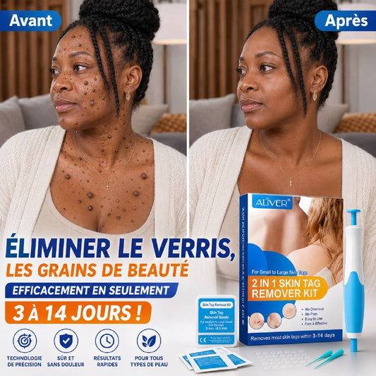 Kit de retrait de verrues et grains de beauté Aliver/ Homme et Femme - Prix : 30$