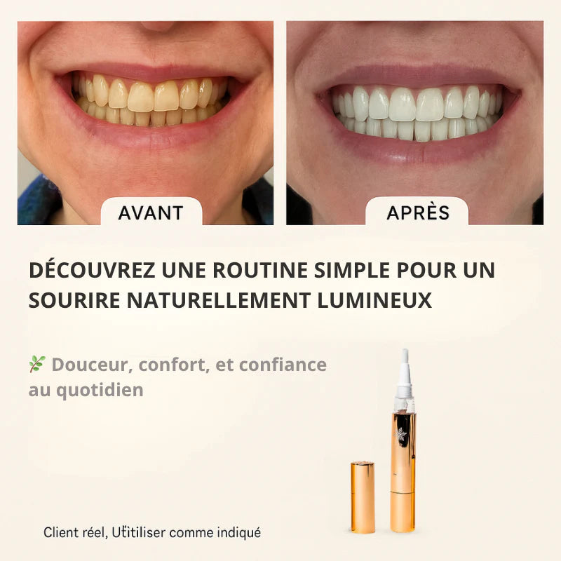 Stylo Blanchissant Dentaire – Résultats Visibles Partout