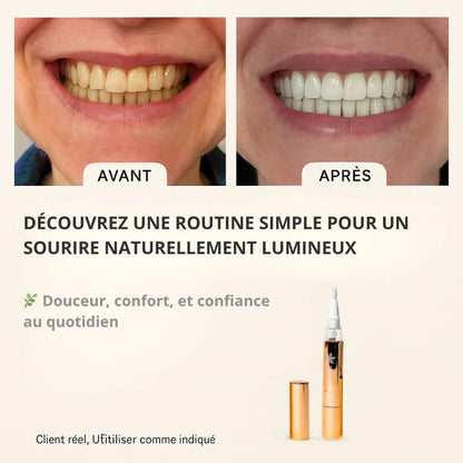 Stylo Blanchissant Dentaire – Résultats Visibles Partout