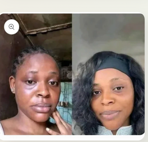 Savon Kojic Éclat Naturel – Ta Peau d’une Douceur Lumineuse, Éclatante et Lisse