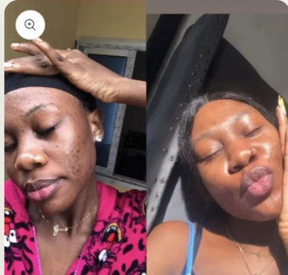 Savon Kojic Éclat Naturel – Ta Peau d’une Douceur Lumineuse, Éclatante et Lisse