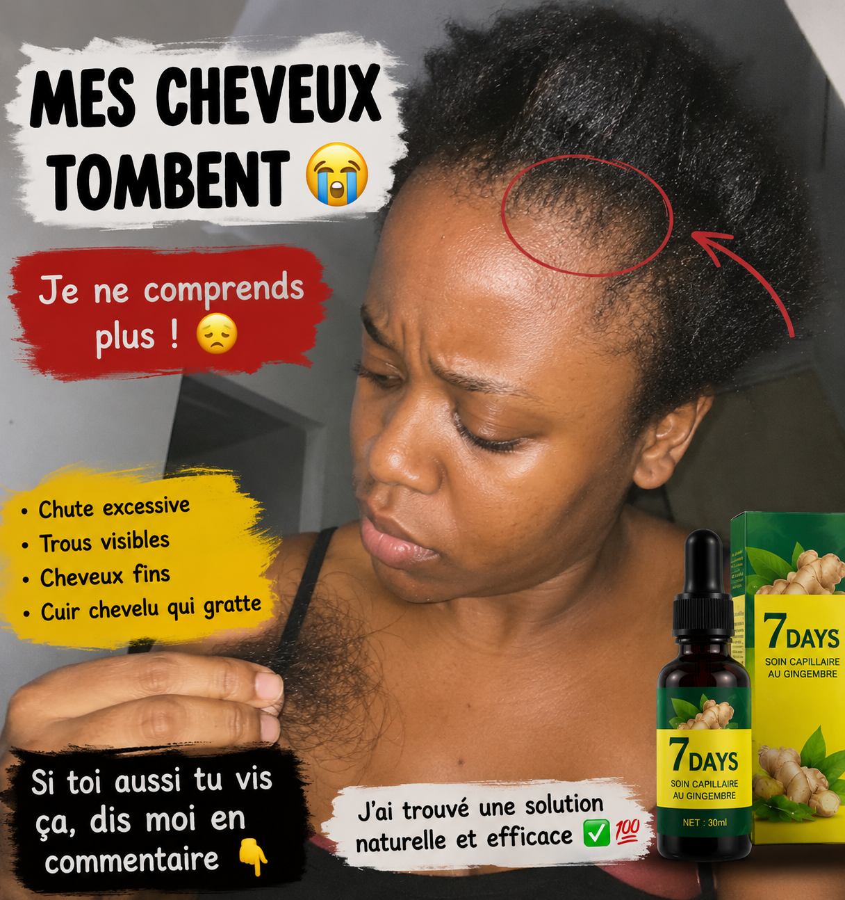Sérum de croissance des cheveux 7 jours