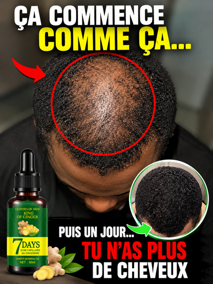 Sérum de croissance des cheveux 7 jours