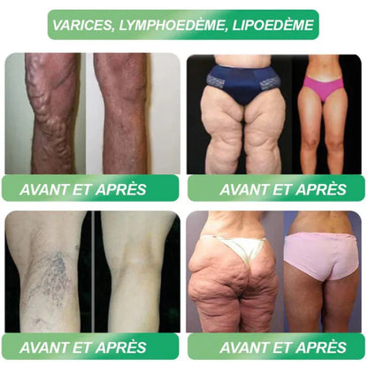 SlimCore™ Élixir Minceur & Anti-Sucre GLP-1 | Perdez 5 kg et contrôlez votre glycémie en 7 jours chrono!