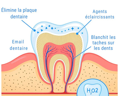 Stylo Blanchissant Dentaire – Résultats Visibles Partout