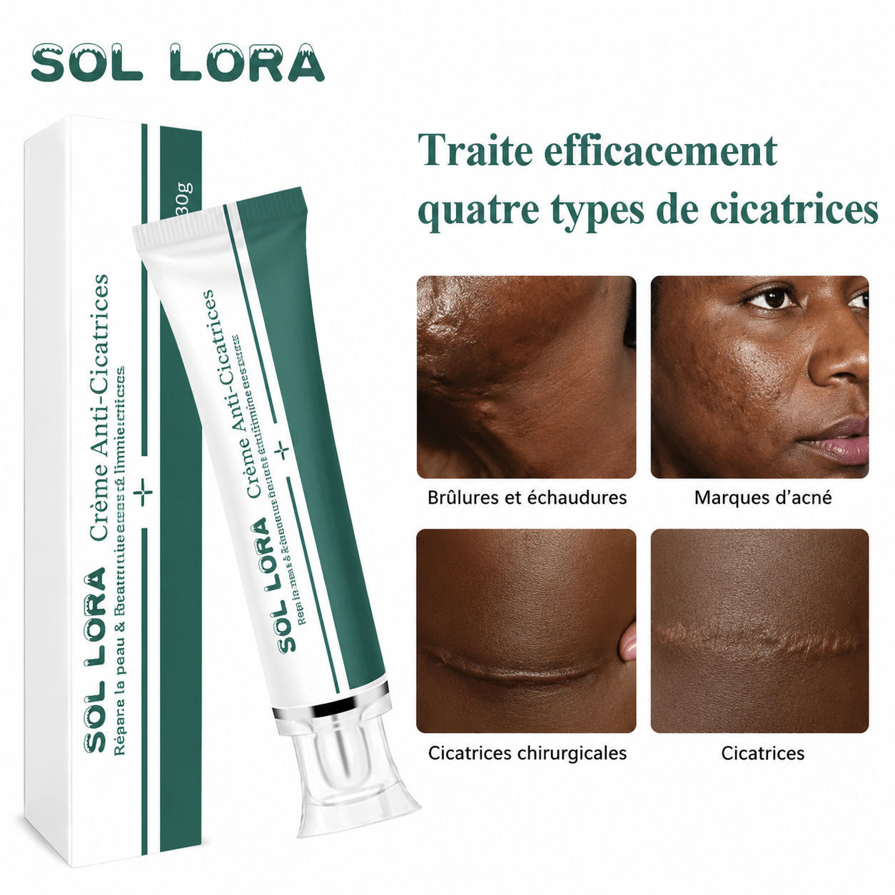 Crème Anti-Cicatrices & Acné-CI