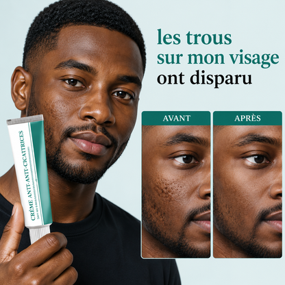 Crème Anti-Cicatrices & Acné-CI