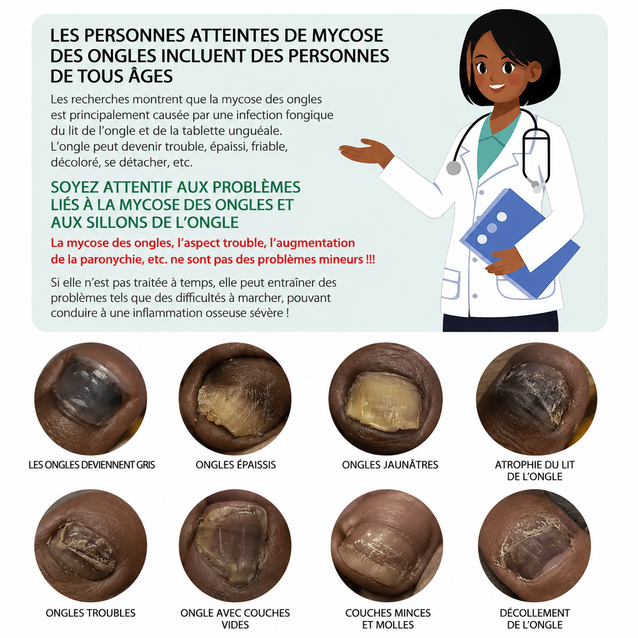 Serum anti-mycose pour Ongles-CG