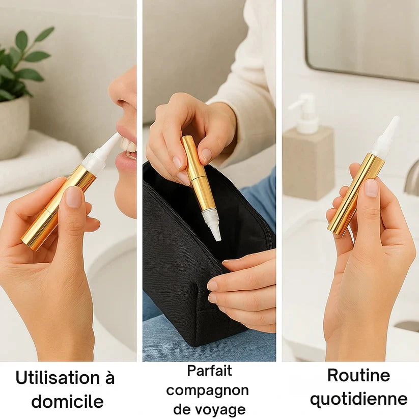 Stylo Blanchissant Dentaire – Résultats Visibles Partout