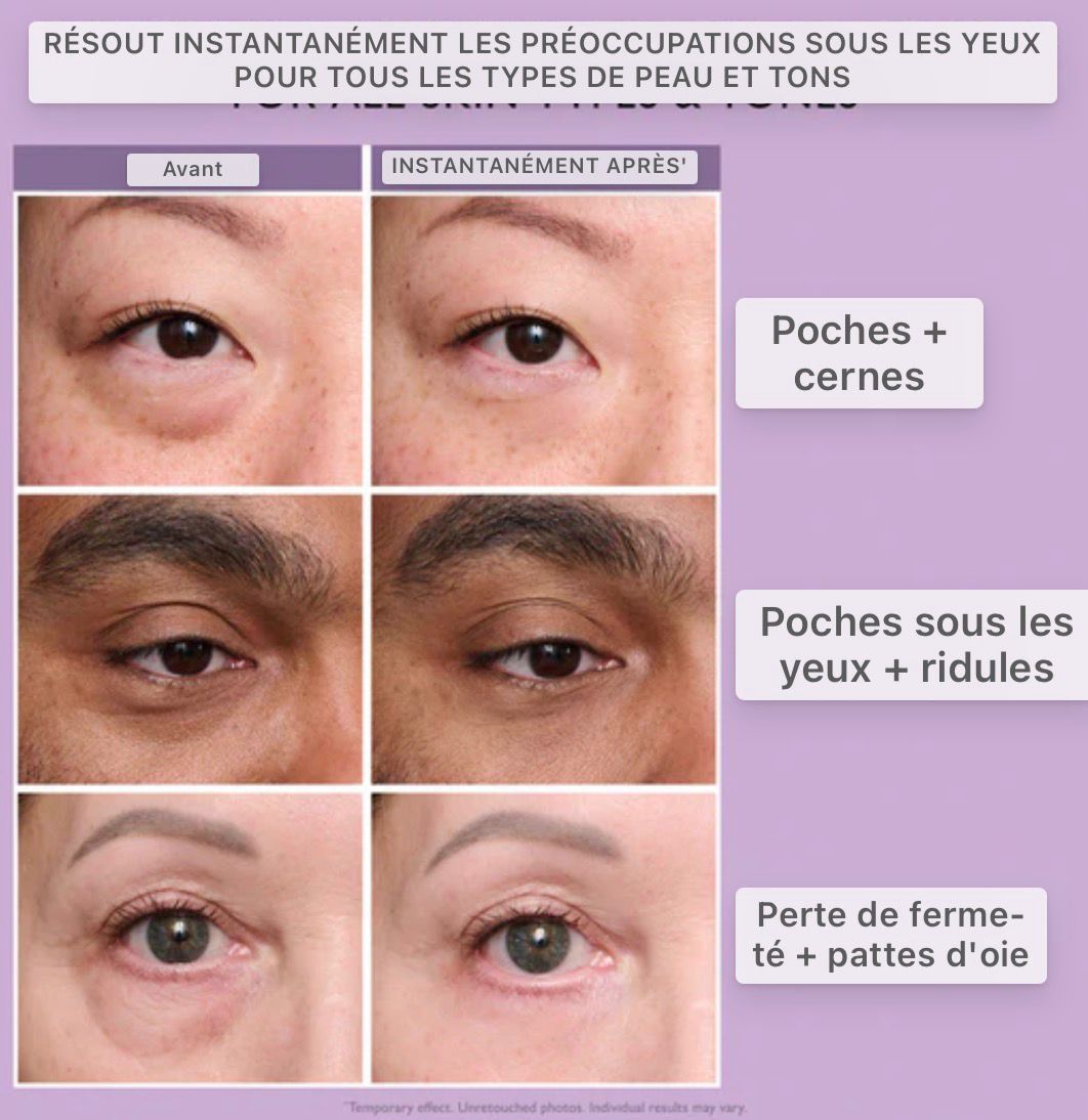Crème Raffermissante pour le Contour des Yeux