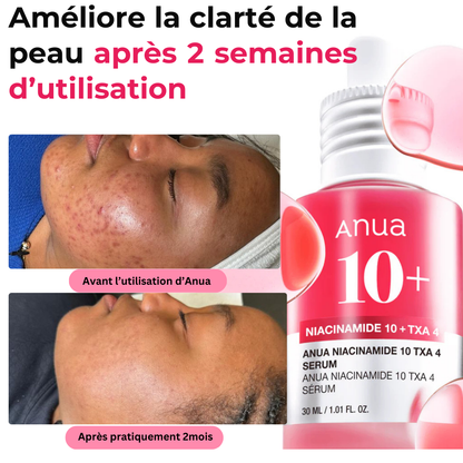 Anua Niacinamide : Dites Adieu aux Imperfections!